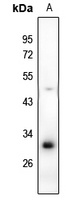 RAB40B Antibody