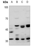 JAB1 Rabbit Polyclonal Antibody