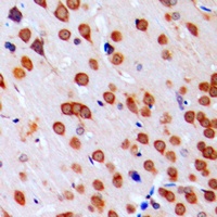 JAB1 Rabbit Polyclonal Antibody