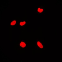 Anti-KAT7 Antibody