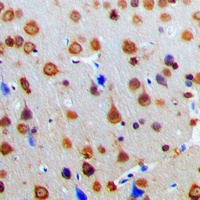 Anti-AKAP13 Antibody