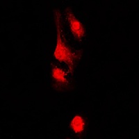 Anti-AKAP13 Antibody