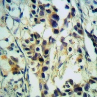 Anti-MRPL3 Antibody