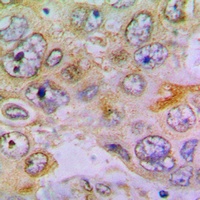 Anti-RPL35 Antibody