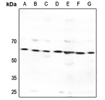 GPR176 Antibody