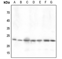 DJ-1 Antibody [KO/KD Validated]