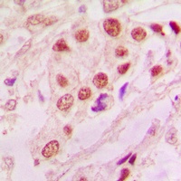 DJ-1 Antibody [KO/KD Validated]
