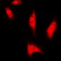 DJ-1 Antibody [KO/KD Validated]