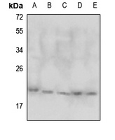 DJ-1 Antibody [KO/KD Validated]