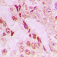 DJ-1 Antibody [KO/KD Validated]
