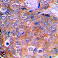 Anti-Cortactin Antibody