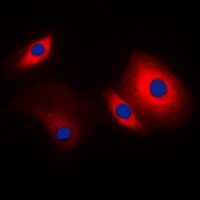 Anti-Cortactin Antibody