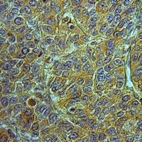 Anti-RASA3 Antibody