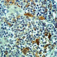Anti-RAB11FIP2 Antibody