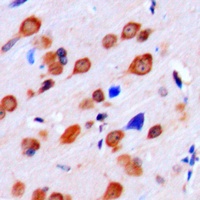 Anti-LMTK2 Antibody