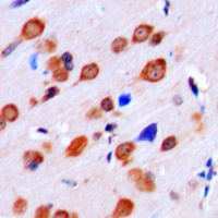 LMTK2 antibody