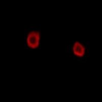 Anti-LMTK2 Antibody