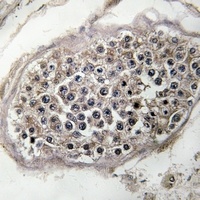 Anti-RAB3GAP1 Antibody
