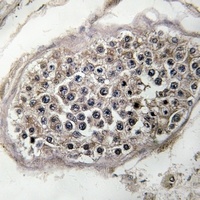 RAB3GAP1 antibody