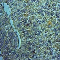 FAIM2 Antibody