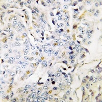 Anti-RBM34 Antibody