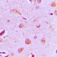 MAST3 antibody