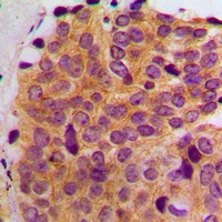 Anti-MAST2 Antibody