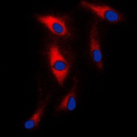 Anti-MAST2 Antibody