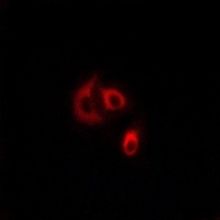Anti-CLCC1 Antibody