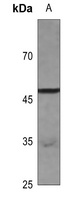Septin 6 Rabbit Polyclonal Antibody