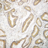 Septin 6 Rabbit Polyclonal Antibody