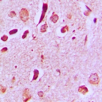JIP3 Antibody