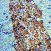 Anti-RGL1 Antibody