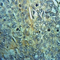 Anti-Raftlin Antibody