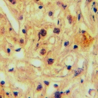 Anti-ABCA5 Antibody