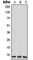 ANP32D Antibody