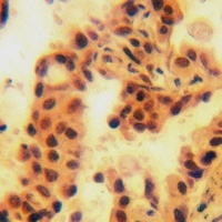 ANP32D Antibody