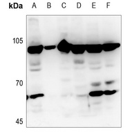 JIP2 Rabbit Polyclonal Antibody