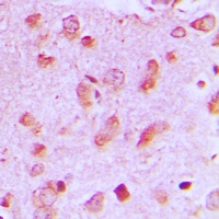 Anti-JIP2 Antibody