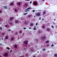 LPAR3 antibody