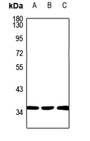 Carbonic Anhydrase 14 Rabbit Polyclonal Antibody