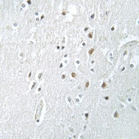 SSBP2 antibody