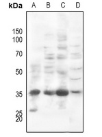 PI-TP beta Rabbit Polyclonal Antibody