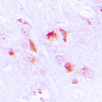 Anti-Apolipoprotein L2 Antibody