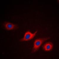 Anti-Apolipoprotein L2 Antibody