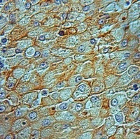 Anti-SHCB Antibody