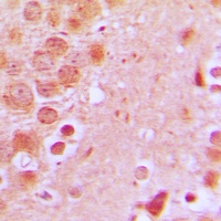 Anti-SCC-S2 Antibody