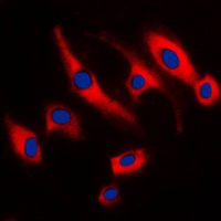 Anti-SCC-S2 Antibody