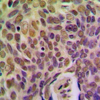 Anti-BRMS1 Antibody