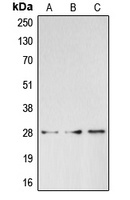 BRMS1 Rabbit Polyclonal Antibody